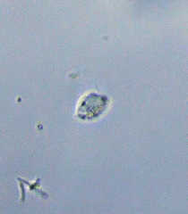 Protozoa