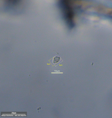 Protozoa