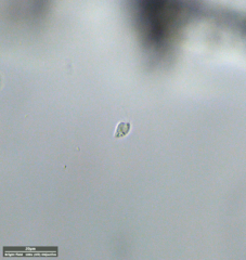 Protozoa