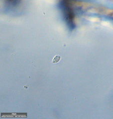 Protozoa
