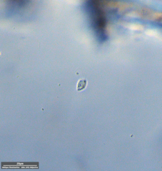 Protozoa