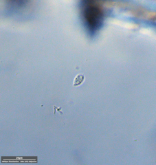 Protozoa
