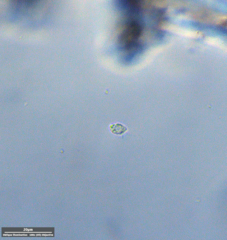 Protozoa