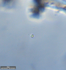 Protozoa