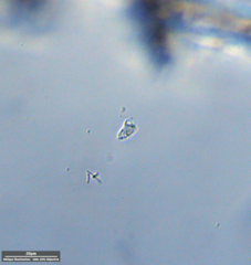 Protozoa