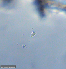 Protozoa