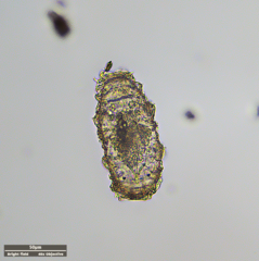 Tardigrada