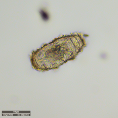 Tardigrada