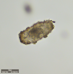 Tardigrada