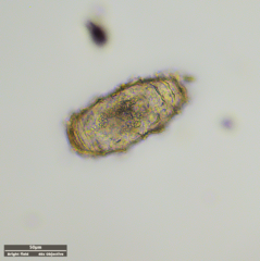 Tardigrada