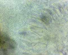 Willeya diffractella