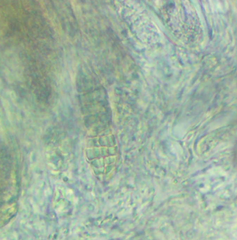 Willeya diffractella