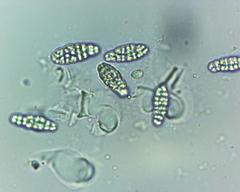 Willeya diffractella
