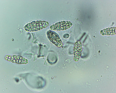 Willeya diffractella