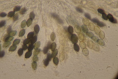 Podospora tetraspora