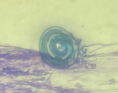 Nematoda