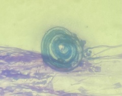 Nematoda