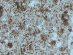 Physarum polycephalum