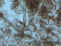 Physarum polycephalum