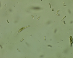 Eutypella