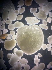 Foraminifera