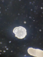 Globothalamea
