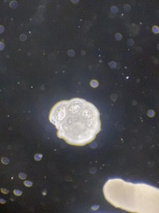 Globothalamea
