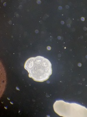 Globothalamea