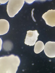 Foraminifera