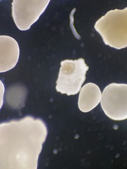 Foraminifera