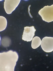 Foraminifera