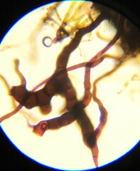 Ephemerum spinulosum