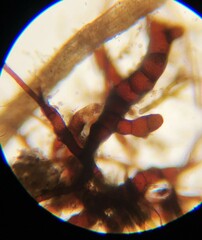 Ephemerum spinulosum