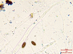 Hypoxylon pseudofuscum