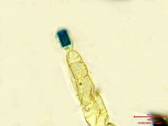 Rosellinia mammiformis