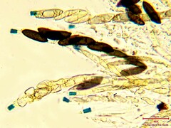 Rosellinia mammiformis