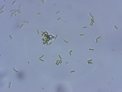 Chaenotheca furfuracea