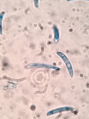 Pseudolachnea hispidula