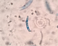 Pseudolachnea hispidula