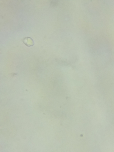 Melanoleuca davisiae image
