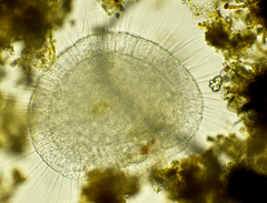 Actinosphaerium
