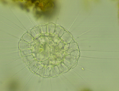 Actinosphaerium