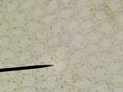 Chiloscyphus pallescens