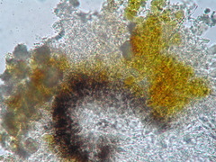 Pyrenocollema halodytes