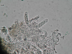 Pyrenocollema halodytes