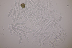 Stagonospora subseriata