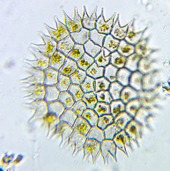 Pseudopediastrum boryanum