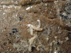 Caecum