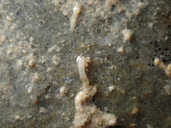 Caecum