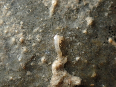 Caecum